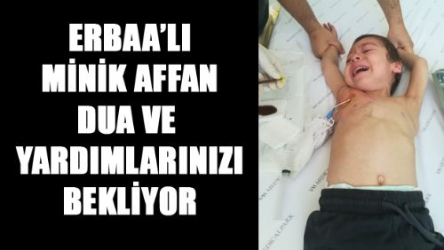 ERBAA'LI MİNİK AFFAN DUA VE YARDIMLARINIZI BEKLİYOR