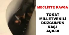 Tokat'lı Vekil Yaralandı